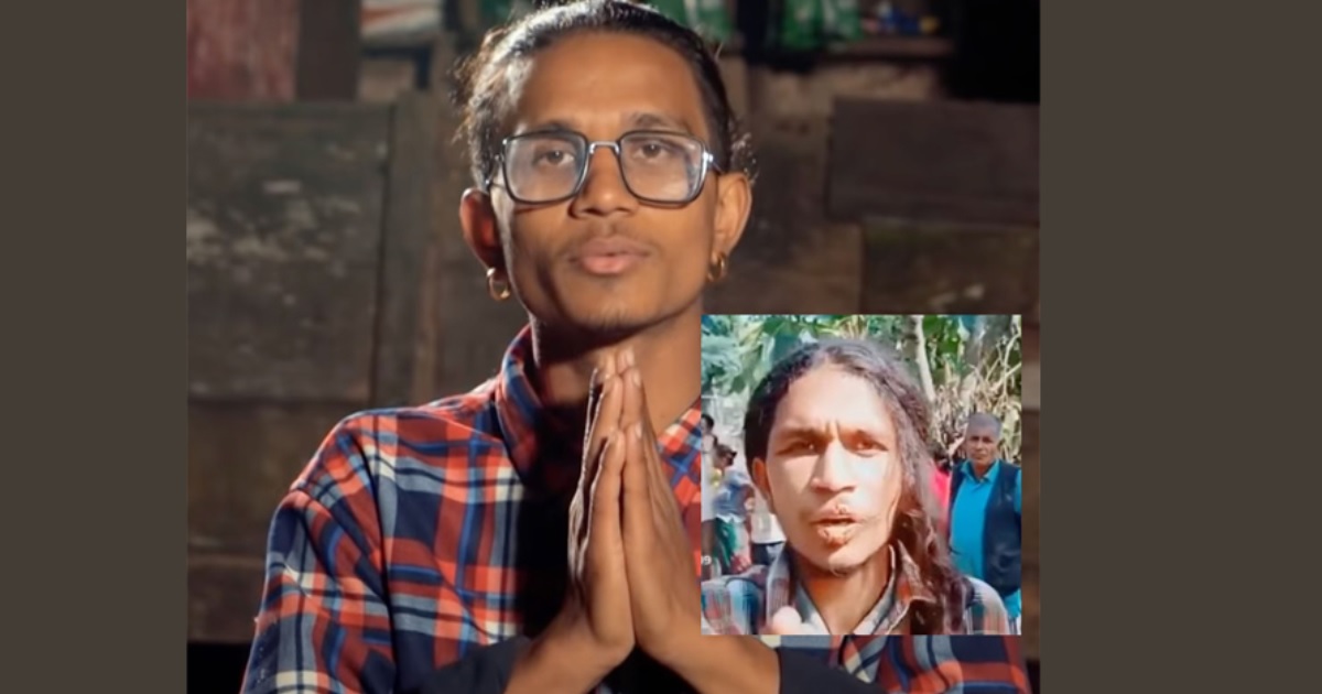 झारफुक गर्ने क्रममा झाँक्रीले अगुल्टो झोस्दा र्‍यापर हप्याकको मुख डढ्यो